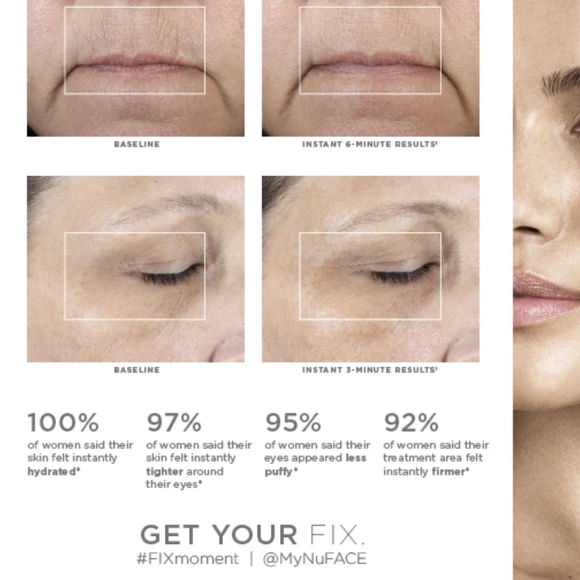 NuFACE White Skincare Device - Picture 2 of 7